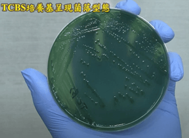圖二、腸炎弧菌培養基(來源：衛生福利部食品藥物管理署研究檢驗組)